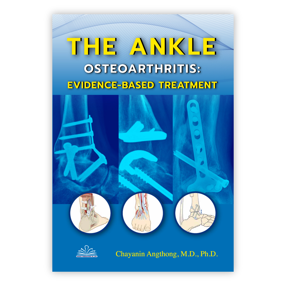 [3 เล่ม รวมค่าจัดส่ง] The Ankle Osteoarthritis Evidence-based Treatment