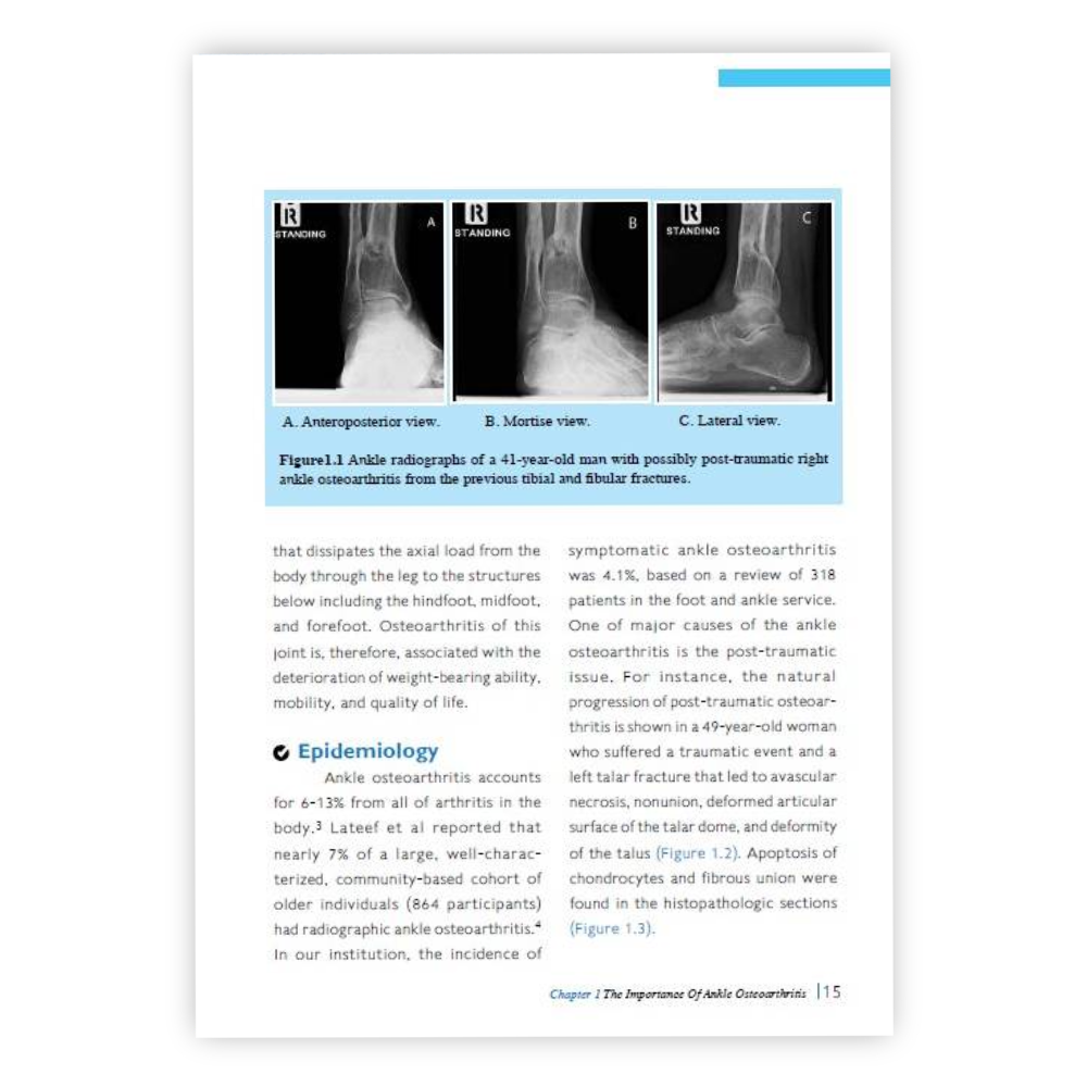 [1 เล่ม รวมค่าจัดส่ง] The Ankle Osteoarthritis Evidence-based Treatment